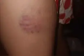 19名小学生作业没完成或做错题，副校长持扫把当众抽打“惩戒”，有学生双腿臀部大片淤青，教育局介入调查图片