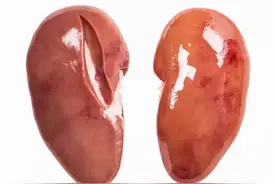 男人吃腰子能养肾？可以以形补形吗？提醒：真正补肾的或是这3个图片