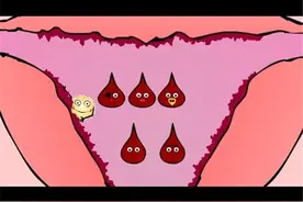 一个月月经来2次，可能是以下7个原因图片