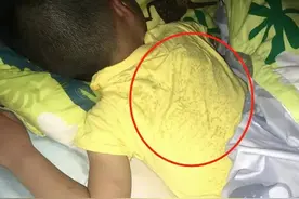 孩子睡觉蒸笼头，后背湿透发凉，中医1个方法调理，适合多数孩子图片