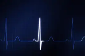 健康早知道：心电图上的“ST-T改变”是什么意思？图片