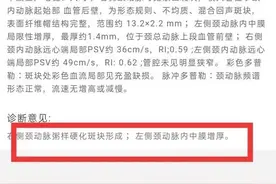 我只是一个冠心病人，不是卖药的，也不是做广告的图片