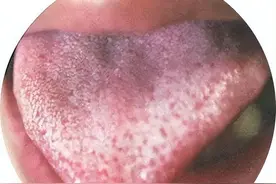 活血先行气，行气先疏肝，教你疏肝行气活血，打通一身经络图片