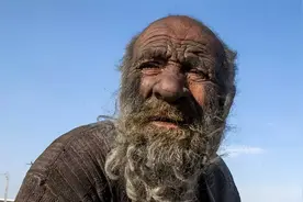 全球最脏的老人，67年坚决不洗澡，被人强迫洗澡，几个月后去世图片
