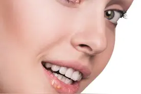 隆鼻修复手术要注意什么，求美者要先了解下面这三点图片