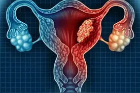 “宫颈”出现问题，身体会出现以下表现，女性要来看看图片