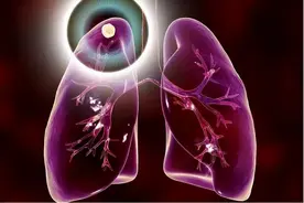 肺结节“喜爱”茄子？医生建议：想要消散结节，应少吃两种食物图片