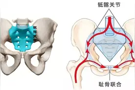 引起骶髂关节痛的原因有哪些？图片