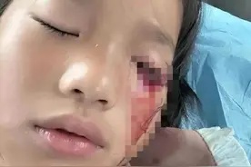 8岁女童被打瞎左眼后续，对方家长不联系不赔偿，我有免死金牌！图片