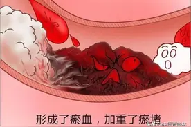 瘀血堵，百病生，送你4种中成药，促血行、通血脉、散淤血图片