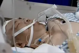 湖南医生病重昏迷，妻子放弃治疗买好寿衣，医生：确认脑死亡图片