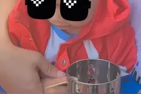 河南洛阳 一男童手卡筷子筒致红肿流血，家长努力施救未果焦急报警求助图片