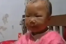 四川“不老女孩”曾玉珊：7岁衰老如老妇，17岁时重获婴儿容颜图片