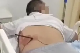 疯了？山东临沂暴徒路边持弓乱射，两人被射鲜血直流，警车被射穿图片