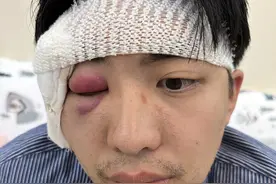 再贵的车也不能阻止我摔跤，记第一次山路骑行滑铁卢事件图片