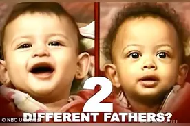 巴西19岁妈妈生下双胞胎，孩子却有两个不同的爸爸？全球仅20例图片