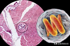大多数囊肿无需处理，如果囊肿出现在这3个地方，要留心图片