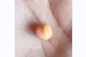 大连女子吃海螺吃出一颗“海螺珠”！专家：小概率事件图片