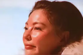 张雨绮形象遭质疑，满脸硅胶，侧面看像猪刚鬣，整容失败？图片