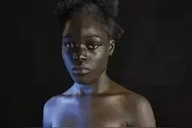 堪比“割礼”的非洲陋习“烫乳”却被他们称之为“母亲的爱”？图片