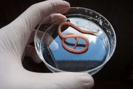 提醒：5种食物是寄生虫的“重灾区”，很多人却经常吃，建议了解图片