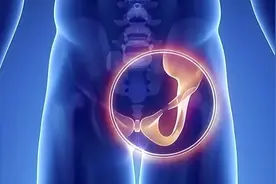 冉冉科普｜腹股沟拉伤，如何重返运动赛场？图片