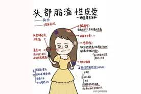 头部脂溢性皮炎受害者的自我治疗分享图片