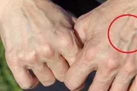 有的人手臂“青筋暴起”，而有的人几乎看不到青筋，哪种更健康图片