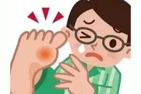 痛风发作，疼的原地打滚。三甲医院药师指导用药，一定要收藏图片