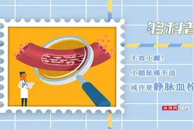 「够科普」小腿肿胀或许是静脉血栓的征兆图片