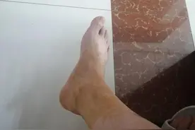 跟腱断裂，分享一下我的经历图片