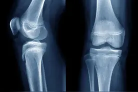 宝妈，你家的孩子正在快速长高图片