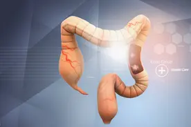 四个隐患，容易导致肠息肉切了还长，越长越多，很多人都没当回事图片