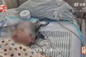 太粗心！因家长疏忽，1岁男童摔倒2个月后突然重度昏迷、离奇病危图片