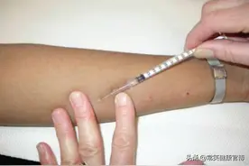 手臂被扎千百遍，只为测出过敏原，过敏原检测怎样才能有效一点？图片