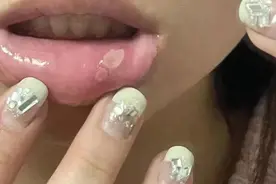 别再说吃饭咬嘴是因为馋肉了，这可能是危险信号！图片