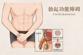 关爱男性健康丨勃起功能障碍的治疗图片