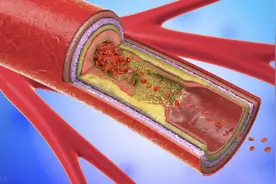 我45岁，老公比我大20岁，居然比我还精力旺盛，有时真应付不了图片
