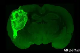 人类会永生吗？科学家成功把人脑细胞植入小鼠大脑中图片