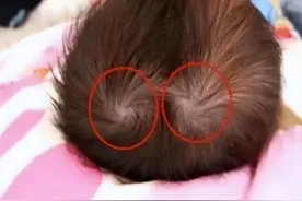 孩子头上“漩涡”代表着什么？影响性格还是智商？我来告诉你答案图片
