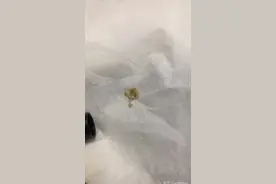 我掏出一块超大耳屎，是种什么体验？图片