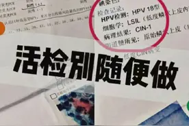 不是感染HPV就得做阴道镜+活检，大家要视情况而定。图片