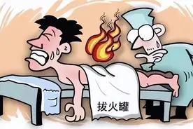 “引火上身”！到底是治疗还是伤身？图片