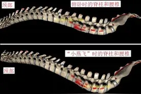 为什么不建议腰椎病患者盲目练习“小燕飞”图片