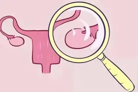 女性是否衰老，卵巢起决定性作用！卵巢保养注意这些要点图片