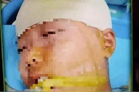 故意还是过失？被打破头骨的女生案件的法律分析图片