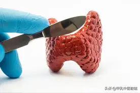 甲状腺是人体内的“发动机”？手术切除后，我发现生活灰暗了图片