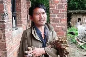 湖南男子吃鱼被"诅咒"，手脚如枯树还开花，20年后医生才查出真相图片