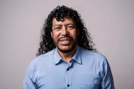 爱美之心！55岁传奇门将厌倦丑陋疯狂整容 英媒：面目全非认不出图片