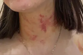 电梯内狗尾巴扫到对方腿，23岁女子遭一对夫妇推搡扯衣胸部裸露？涉事业主夫妇否认，自贡警方已展开调查图片